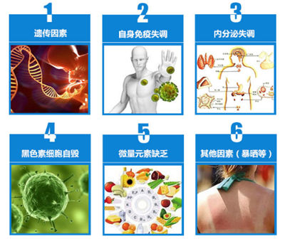 皮肤白斑怎么回事