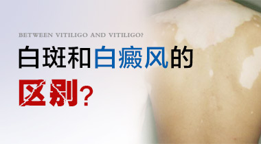 白斑和白癜风有何区别